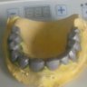 dental