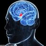 hypothalamus